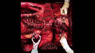 200 STAB WOUNDS - Manual Manic Procedures (Full Album)